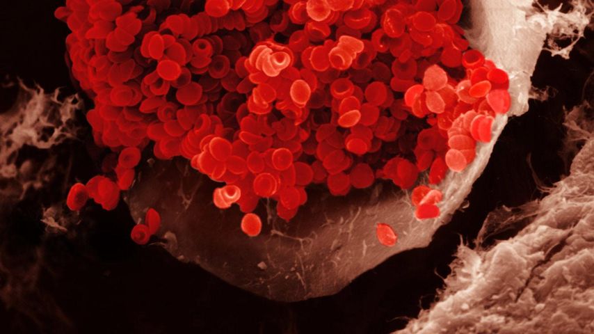 Rote Blutkörperchen in einem Blutgefäß. Erythrozyten haben eine bikonkave Form und stellen die grundlegende Form des Sauerstofftransports im Blut dar. REM X1000